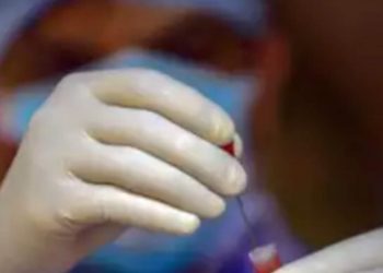 Mucormycosis kills 16 in Aurangabad in second wave