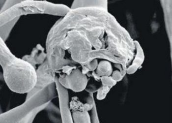 ‘Black Fungus’ takes the lives of 90 people in Maharashtra, says Minister