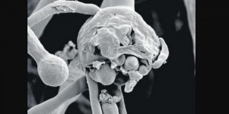 ‘Black Fungus’ takes the lives of 90 people in Maharashtra, says Minister