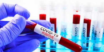 Delhi reports 12,651 Covid cases in last 24 hrs, 20% drop in positive reports