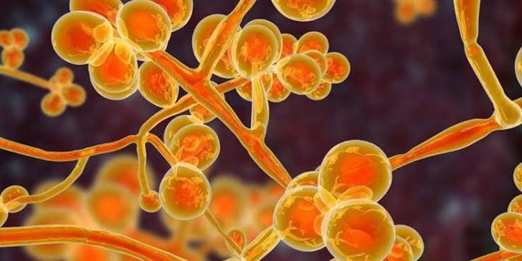 First case of yellow fungus reported in Ghaziabad, Uttar Pradesh