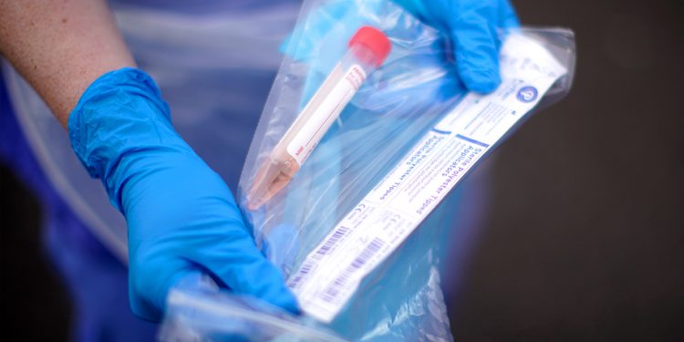 22,17,320 samples tested for Covid in India- ICMR