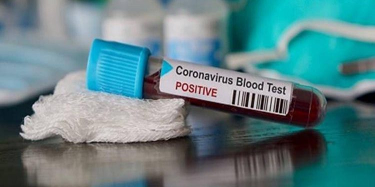 States Like Maharashtra and Kerala Still Continues To Record High Positivity Rate