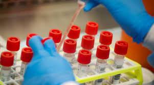 Traces of SARS-Cov-2 detected in Pune’s Wastewater from different areas.