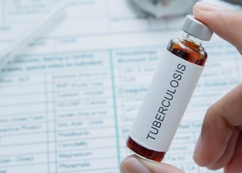 Now TB Medicine Effectiveness Can Be Tested in Just Two Hours