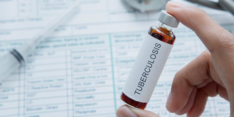 Now TB Medicine Effectiveness Can Be Tested in Just Two Hours